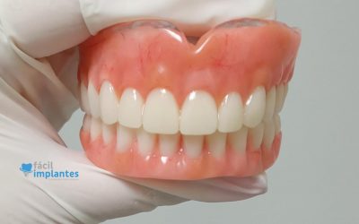 QUEM NÃO PODE FAZER UM IMPLANTE DENTÁRIO?