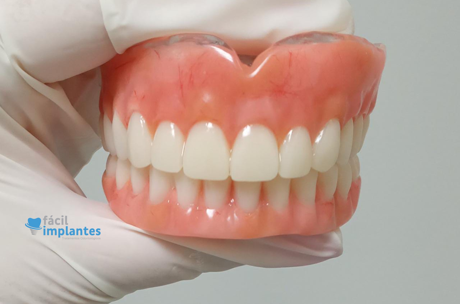 QUEM NÃO PODE FAZER UM IMPLANTE DENTÁRIO?