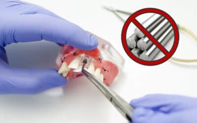 Implante Dental livre de Alumínio