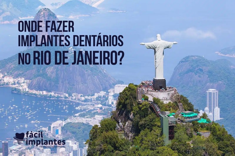 Onde fazer implante no Rio de Janeiro?